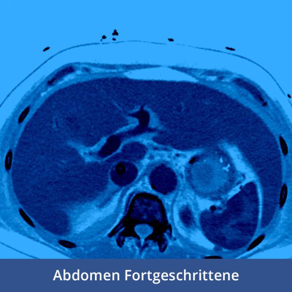 RFN goes online - Wochenendkurs Abdomendiagnostik für Fortgeschrittene, 12.-13. Februar 2022