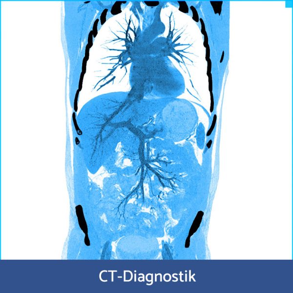 RFN Online - Wochenendkurs The rising lecturers CT-Diagnostik, 08.- 09. November 2025