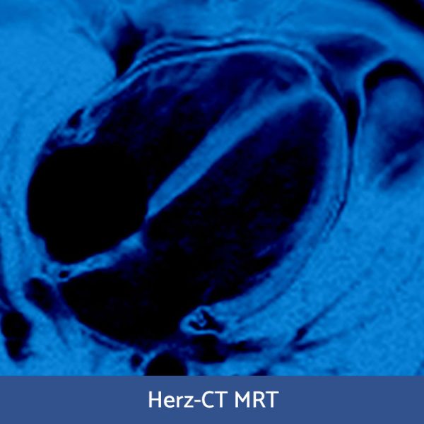 RFN goes online - Wochenendkurs Herzdiagnostik (CT/MRT), 12-13. Februar 2022