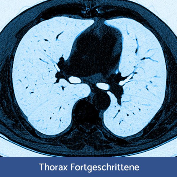 RFN Online: Wochenendkurs Thoraxdiagnostik für Fortgeschrittene, 08.- 09. November 2025