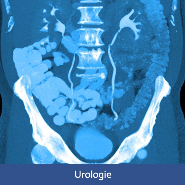 RFN Online - Wochenendkurs MasterRad Uroradiologie inkl. Q1 Prostata (DRG), 08.- 09. November 2025