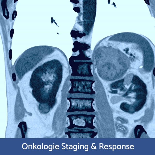 RFN Online - Wochenendkurs MasterRad Onkologie Staging und Response, 08.- 09. November 2025